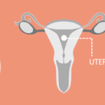 Uterine-Endometrial-Cancer